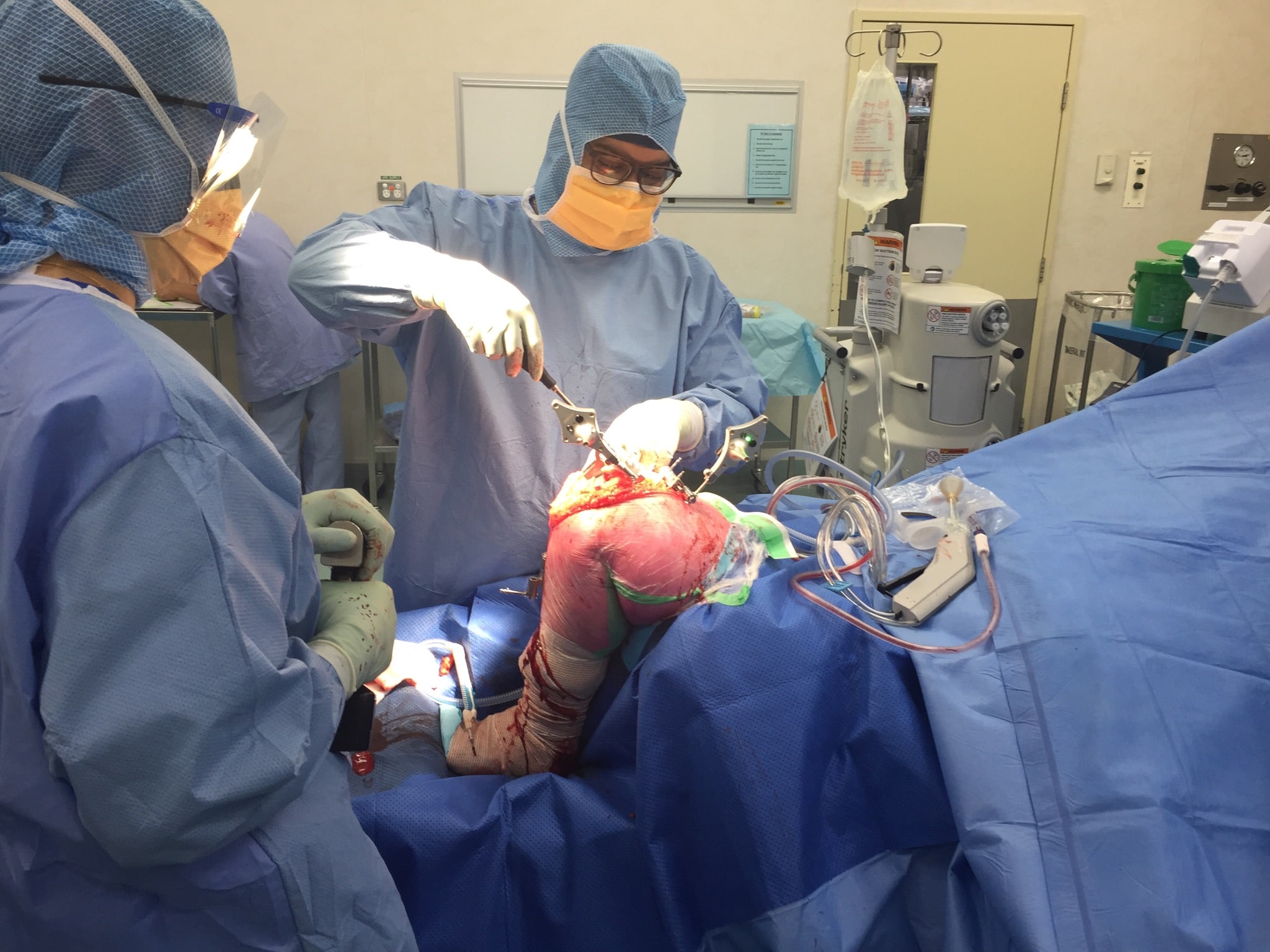 Read more about the article Patient Success Stories: How Kolkata’s Top Orthopedic Surgeons Are Changing Lives