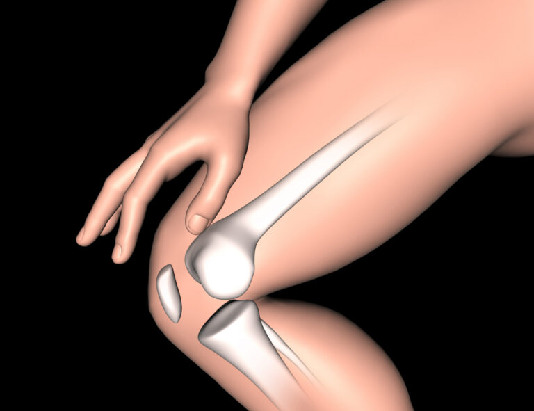 Read more about the article Expert Advice from Dr. Amit Roy, Kolkata’s Top Orthopedic Surgeon on Managing Knee Replacement Surgery